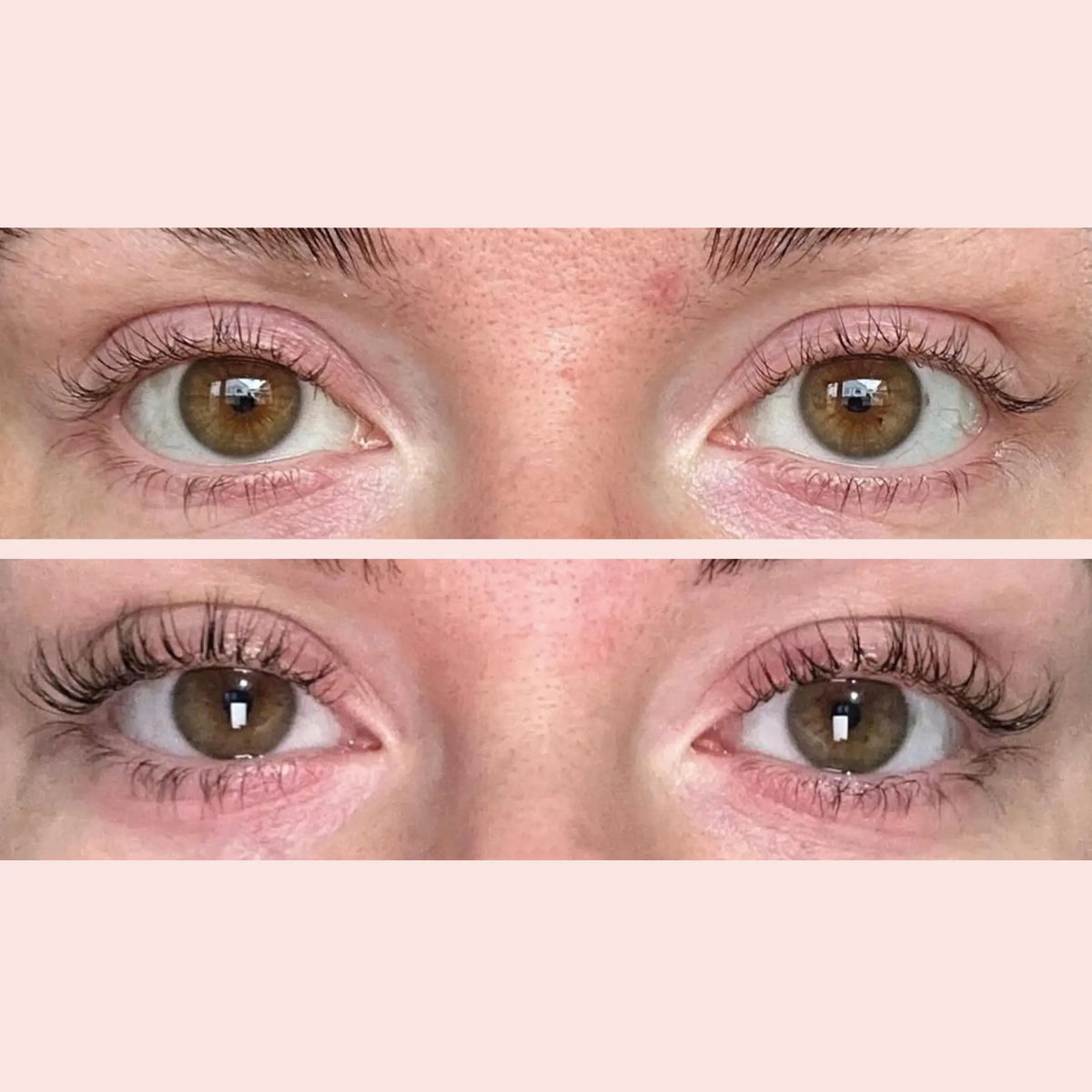Vorher-Nachher-Vergleich der Wimpern beider Augen – oben vorher, unten nachher